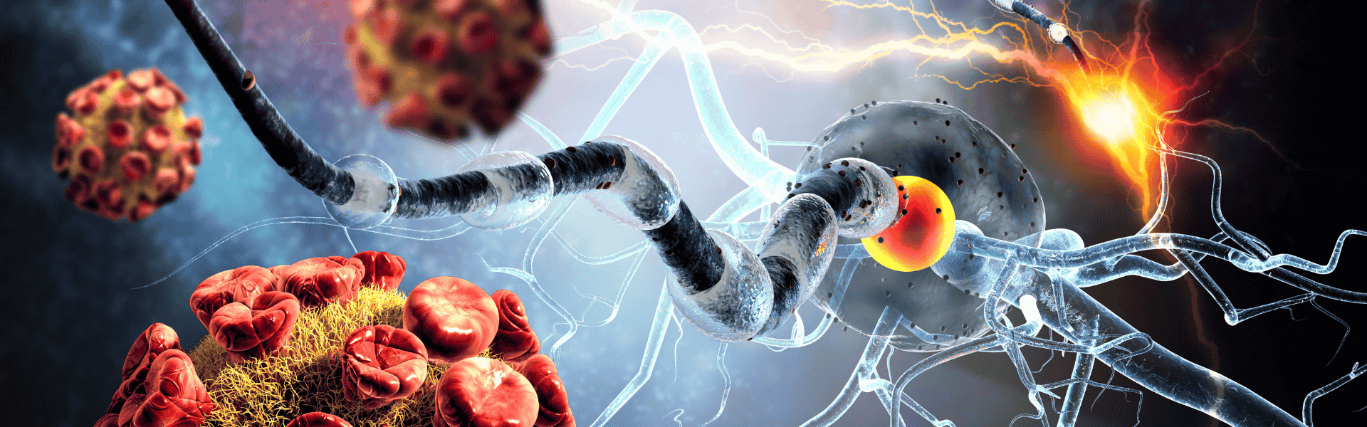 Multiple Sclerosis Research